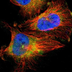 QSER1 Antibody, Novus Biologicals 25 &mu;L; Unlabeled:Antibodies, Polyclonal